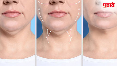 double chin exercises