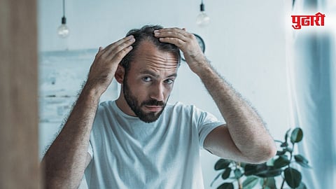 Hair Fall Cure And Fertility