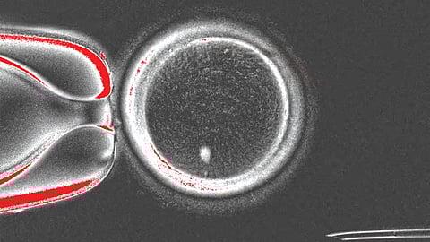 Human Skin cell embryo
