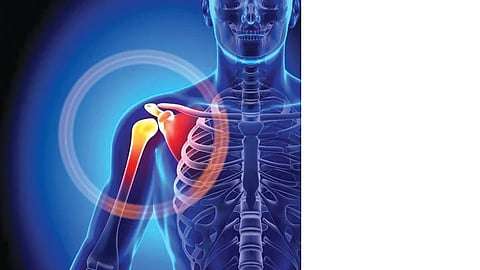 Shoulder Dislocation Problem