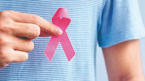 Male Breast Cancer Symptoms