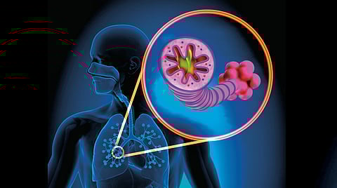 COPD symptoms warning