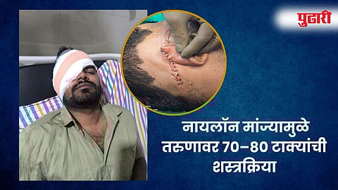 सिन्नर  (नाशिक) 