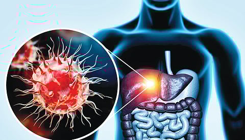 Cancer patient treatment