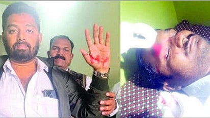 Nylon string injuries