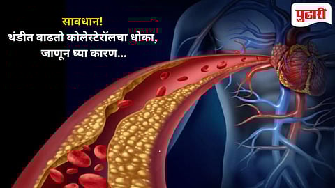 Winter Cholesterol Risk