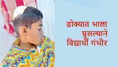 Student critically injured