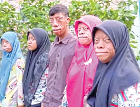 Face Changing Disorder