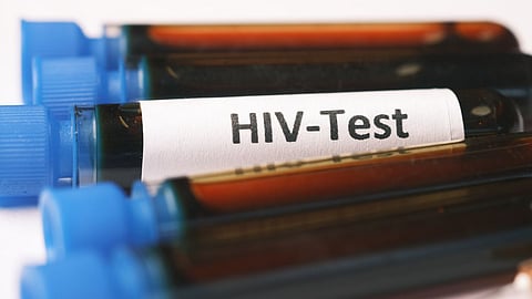 HIV Discrimination Employment