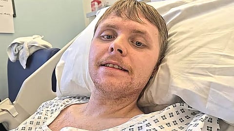 Dementia Brain Donation