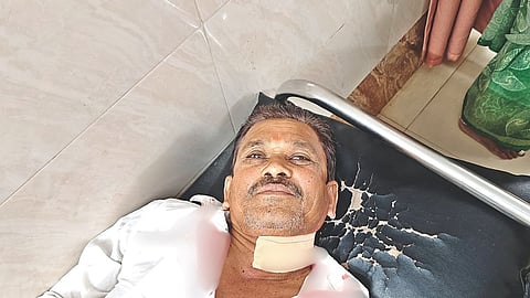 Manja Injury Incident