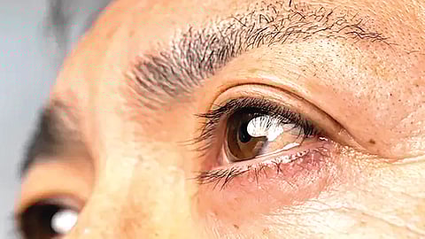 Color Blindness Bladder Cancer Risk | 