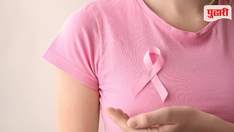 AI Digital Mammography