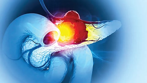 Triple Drug Therapy Thyroid Cancer