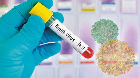 Nipah virus Japan vaccine trials