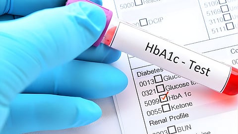 HbA1c test 