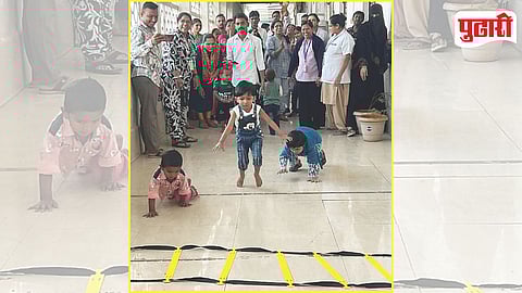 Clubfoot Treatment Success