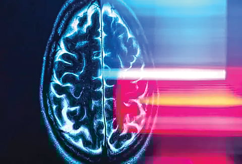 Space travel brain changes |