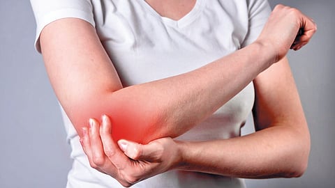 complex regional pain syndrome