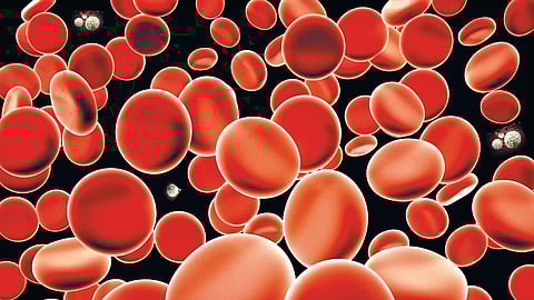 High Hemoglobin |
