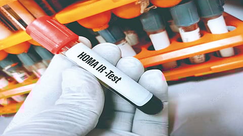 Diabetes diagnosis accuracy |