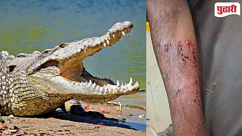 Kumbhoj Fisherman Attacked by Crocodile