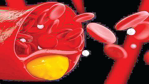 Cholesterol control young age