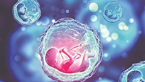 ‌Asherman syndrome