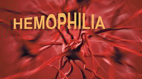 Haemophilia patients 