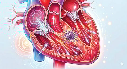 Heart Cancer | 