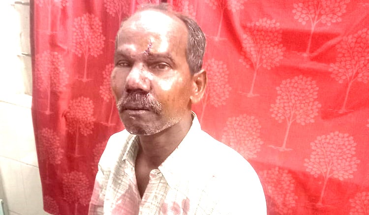 சென்னை: மதுபோதையில் வீடுபுகுந்து வளர்ப்பு நாயை அடித்துக் கொன்ற நபரால் பரபரப்பு! | Chennai Drunk man beats dog to death