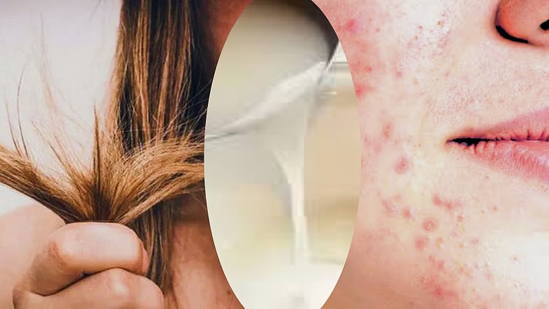 தோல் பிரச்னை முதல் முடி பிரச்னை வரை... அரிசி கழுவும் தண்ணீரில் இவ்வளவு நன்மைகளா? / health and beauty benefits of rice water 