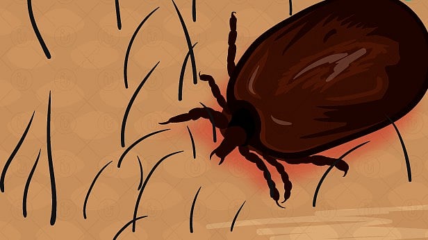 ஸ்க்ரப் டைபஸ் காய்ச்சல் என்றால் என்ன மருத்துவர் விளக்கம் /what is scrub typhus fever explained by doctor