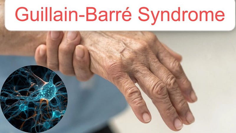 மகாராஷ்ட்ரா: GBS நோய்த் தாக்குதலால் ஒருவர் மரணம்? / Maharashtra reports one suspected death of Guillain Barre Syndrome