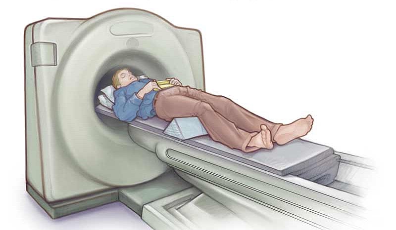 அடிக்கடி சிடி ஸ்கேன் எடுப்பவரா நீங்கள்? காத்திருக்கும் பெரிய அதிர்ச்சி!