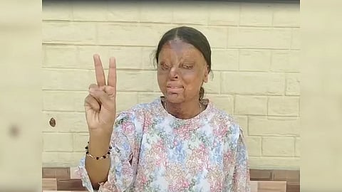 chandigarh student lost eyes in acid attack scores 956 in class 12 boards