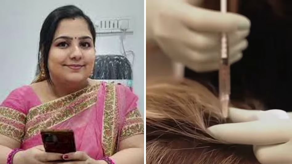 முடி மாற்று அறுவைசிகிச்சை செய்த பல் மருத்துவர்கள்... பரிதாபமாக உயிரிழந்த இருவர்!