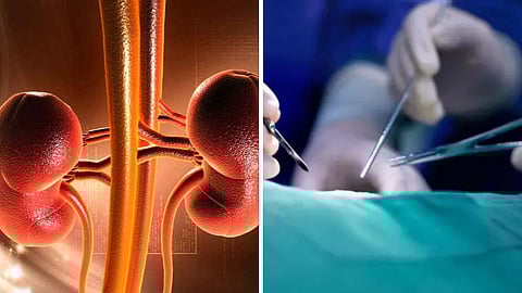 நாமக்கல் கிட்னி விற்பனை சம்பவம்