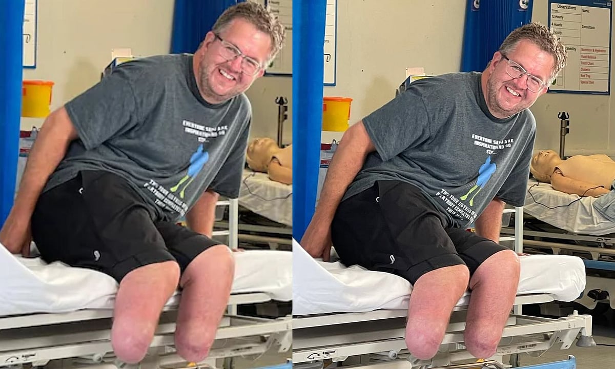 ரூ.5 கோடி காப்பீட்டு தொகைக்காக 2 கால்களை தானாக இழந்த மருத்துவர்; இறுதியில் காத்திருந்த டிவிஸ்ட்!