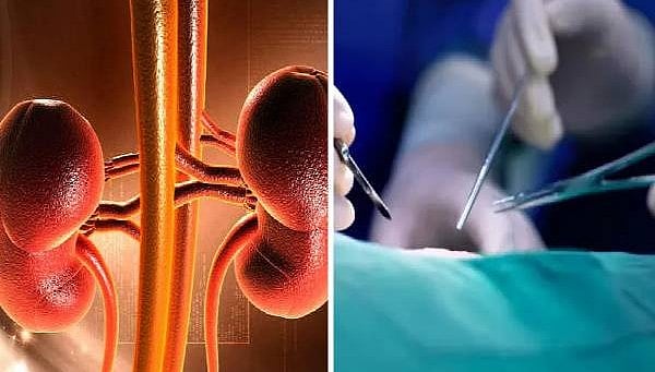 தமிழகத்தை உலுக்கிய கிட்னி விற்பனை |