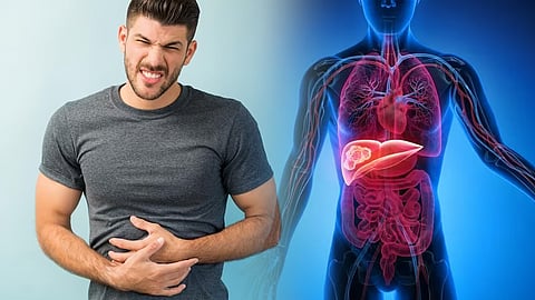 அதிகரிக்கும் கல்லீரல் நோய் மரணங்கள்