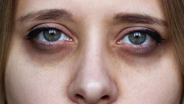 கருவளையம்