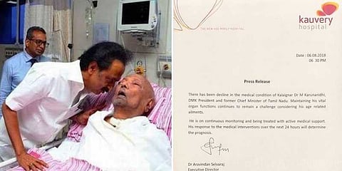 “கருணாநிதியின் உறுப்புகளை செயல்பட வைப்பதில் சவால்” - அறிக்கை 