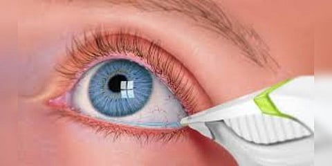 "கணினி, செல்போன்களை இடைவிடாமல் பார்க்க வேண்டாம்"  - 'உலர் கண் நோய்' எச்சரிக்கை