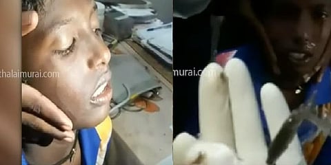 கிணற்றில் குளித்தபோது சிறுவனின் மூக்கில் புகுந்த 'ஜிலேபி' மீன்!