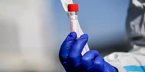 கொரோனா பரிசோதனை முடிவுக்கு சில நிமிடங்கள் போதும்; இதுதான் ஆன்டிபாடி சோதனை!!