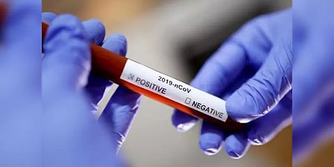 தமிழக தலைமைச் செயலாளரின் தாயாருக்கு கொரோனா பாதிப்பு