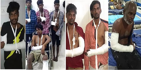 `வழுக்கி விழுந்து கை - கால் உடைந்த’ கைதிகள் லிஸ்ட்! - 4 ஆண்டுகளில் எத்தனை பேர்?