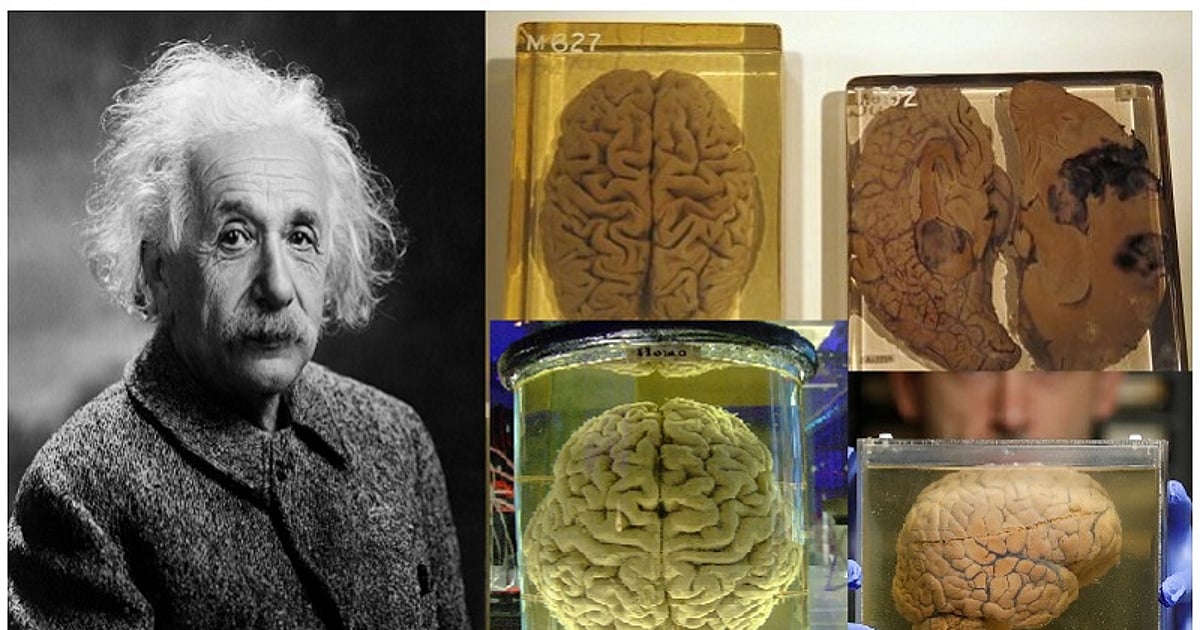 Einstein Lab einstein brain was theft. because of he was genious. Doctors said we ...