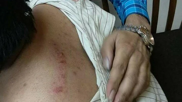 تصویر سوشل میڈیا